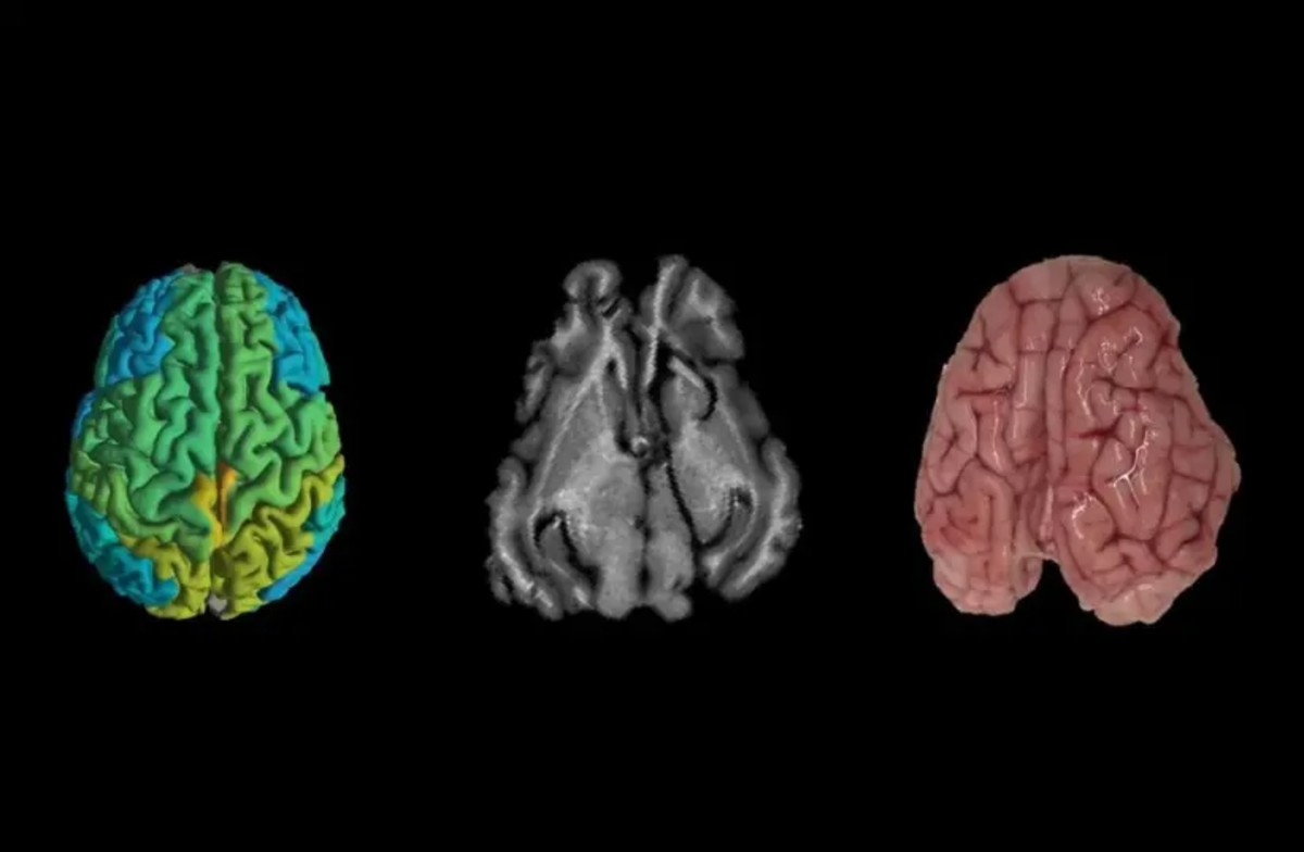 Technion Descubre Como Reducir El Dano Cognitivo De Las Enfermedades Cerebrales Enlace Judio